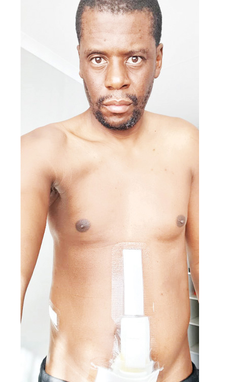Gobabis man claims violent attack by girlfriend