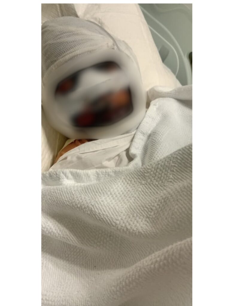Mother appeals for help after 13-year-old son suffers severe burns