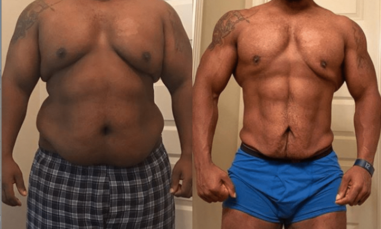 Weight loss craze squeezes diabetes drug supply