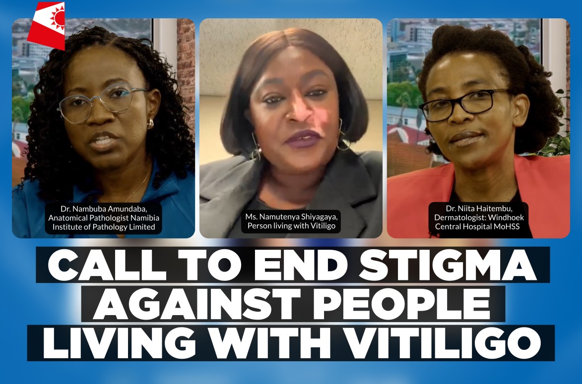 Namibia marks World Vitiligo Day with call to end stigma and support those living with condition