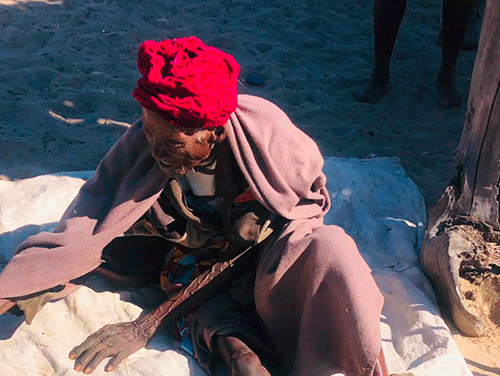 Shamvhura’s amputation exposes rural disability crisis …pensioner cries for wheelchair